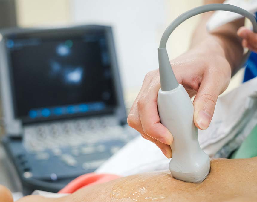 Mano de una doctora realizando un ecocardiograma mediante un ultrasonido. A un lado se encuentra el ecocardiógrafo