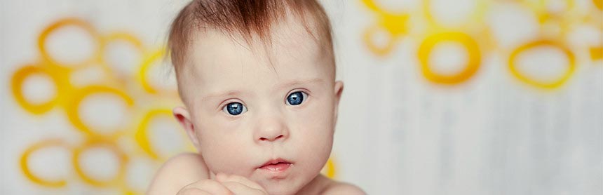 Niño pequeño de ojos azules con síndrome de Down