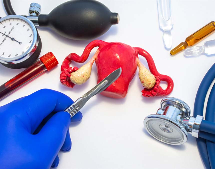 Mano de médico sosteniendo un bisturí. A su lado hay un prototipo de un útero, un estetoscopio, un baumanómetro y tres ampolletas