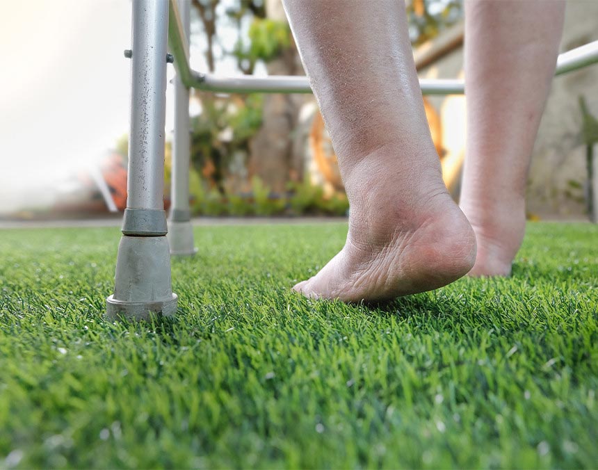 Pies de un paciente con retención de líquidos, caminando descalzo con una andadera gris sobre el pasto de un jardín