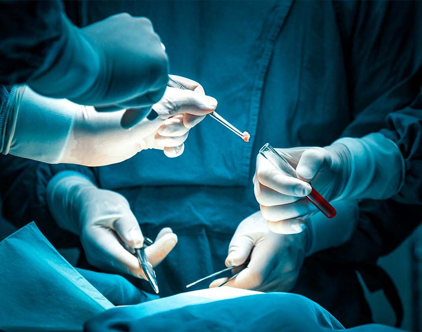 Tres médicos vestidos con pijamas azules para cirugía y guantes blancos, realizando una biopsia y colocando la muestra en un tubo