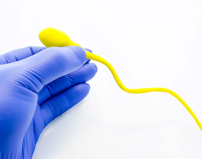 Mano de un médico con un guante azul, sosteniendo el prototipo de un espermatozoide de color amarillo