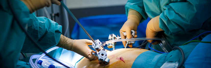 Dos médicos con pijamas para cirugía y guantes blancos, realizando un procedimiento quirúrgico por laparoscopia