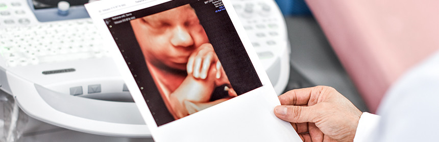 Mano de un médico sosteniendo una ecografía donde se puede ver la cara y brazos del bebé