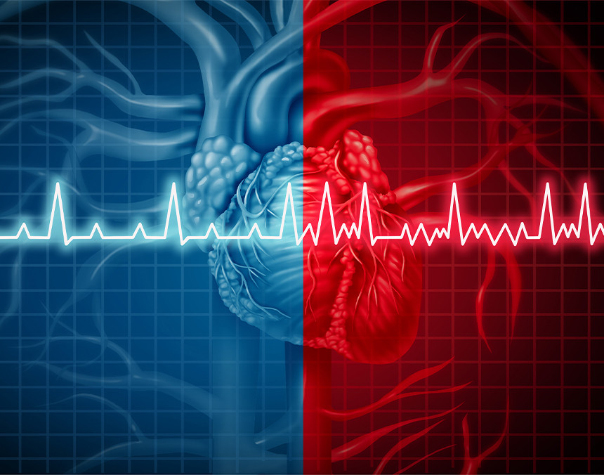 Imagen gráfica de corazón en color azul y rojo, y el ritmo de una frecuencia cardiaca anormal encima