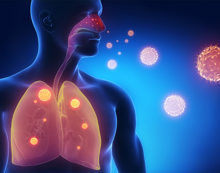 Ilustración 3D del sistema inmunológico en color azul con los pulmones rojos, siendo atacado por el virus de la influenza