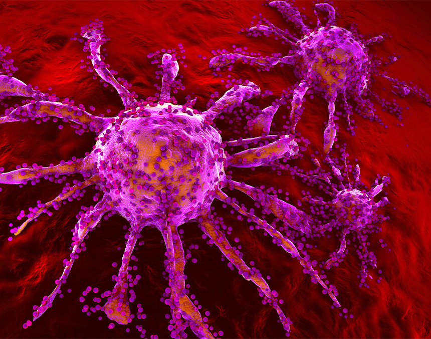 Ilustración 3D de una célula cancerosa rosa que se está propagando en el tejido sano