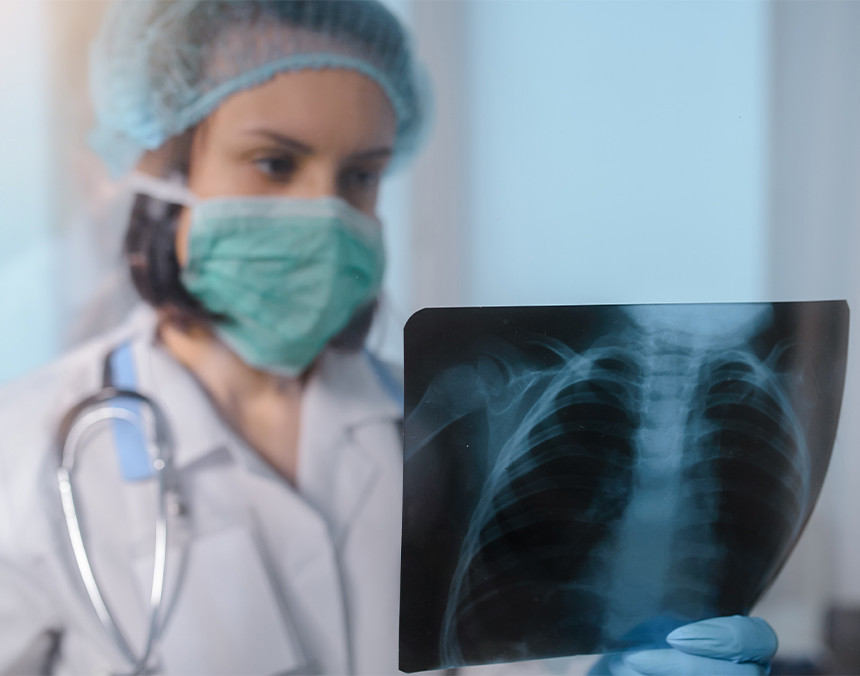 Doctora joven con bata blanca, gorro y cubrebocas analizando una radiografía de tórax