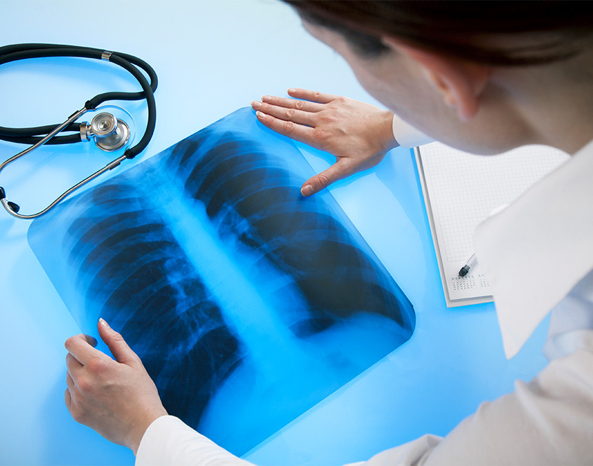 Hipertensión pulmonar, sus principales síntomas