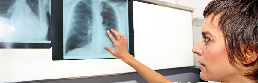 Doctora observando detenidamente una radiografía de ambos pulmones