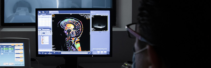 Doctor viendo en una pantalla la imagen del cerebro de un paciente que se realizó una resonancia magnética