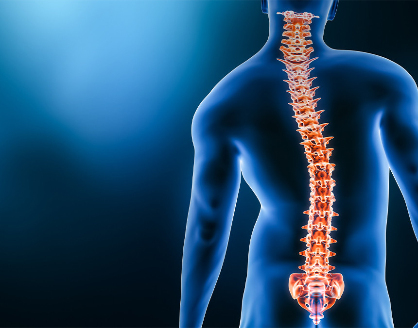Ilustración 3D del cuerpo de un hombre en color azul con una curvatura en la columna vertebral