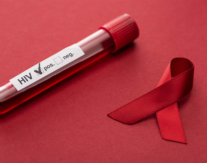 Muestra de laboratorio que indica positivo a VIH y una cinta roja a un lado. Ambos están sobre un fondo rojo