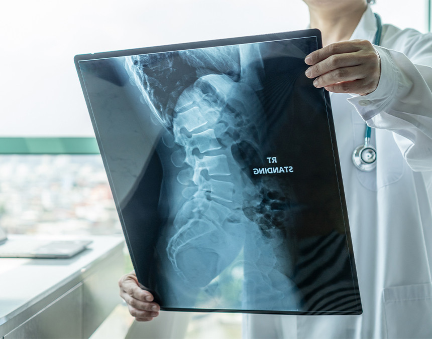 Médico con bata blanca sosteniendo una radiografía de una columna vertebral