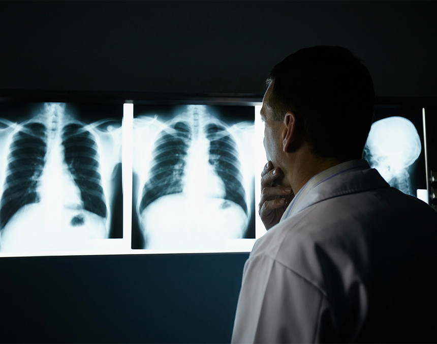 Médico con bata blanca observando tres radiografías del tórax y el cráneo