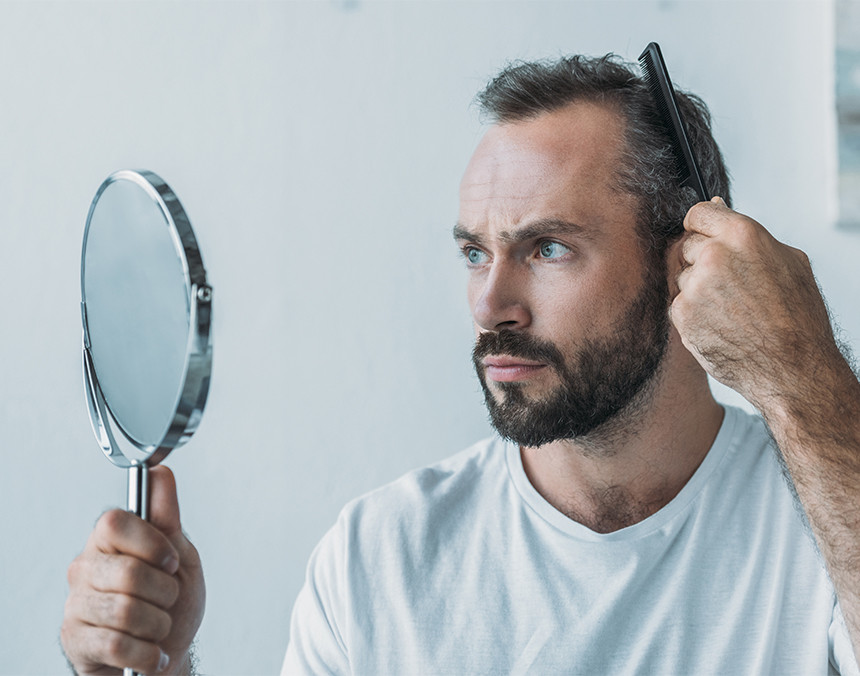 Hombre que presenta alopecia peinando su cabellos y viéndose en un espejo