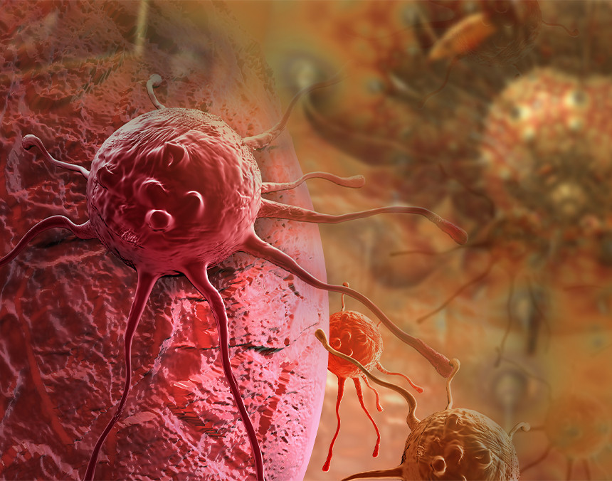 Ilustración 3D de una célula cancerosa d color rojo en el cuerpo humano