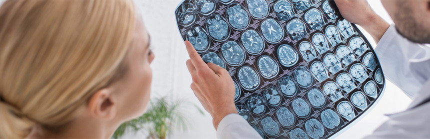 Médico con bata blanca mostrando una radiografía del cerebro en diferentes ángulos a una paciente