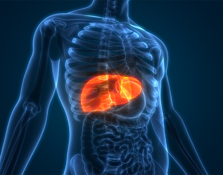 ¿Cómo saber si tienes hígado graso?