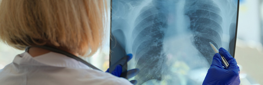 Doctora con cabello corto y vestida con bata blanca, analizando una radiografía de los pulmones