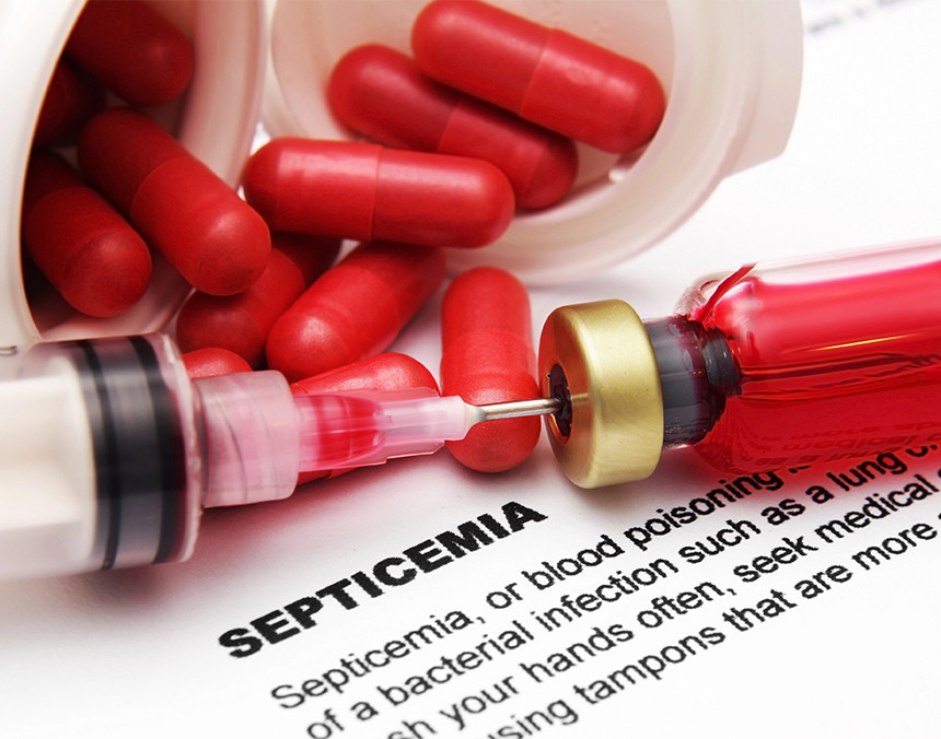 Septicemia: ¿Qué es y cómo se puede prevenir?