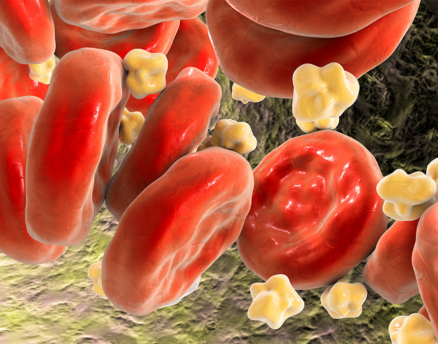 Ilustración 3D de glóbulos rojos con moléculas de colesterol y triglicéridos