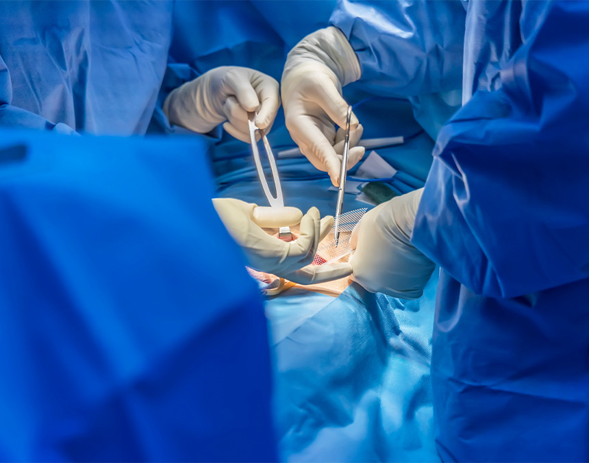 Tres médicos con pijamas para cirugías realizando una cirugía de hernia a un paciente dentro de un quirófano