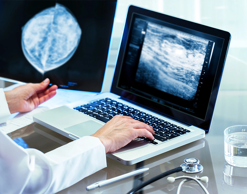 Computadora mostrando un estudio de imagen de la mama. A lado la mano de una doctora sostiene una radiografía