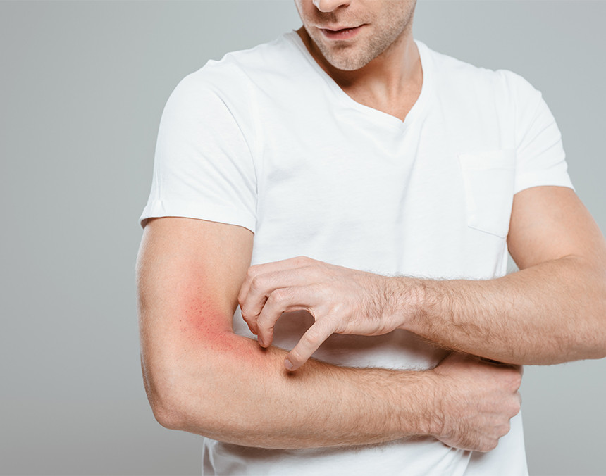 Dermatitis, ¿cómo se cura?