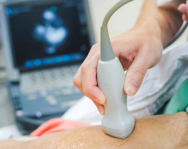 Ecocardiograma: qué es y para qué sirve
