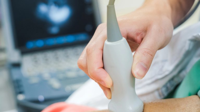 Ecocardiograma: qué es y para qué sirve