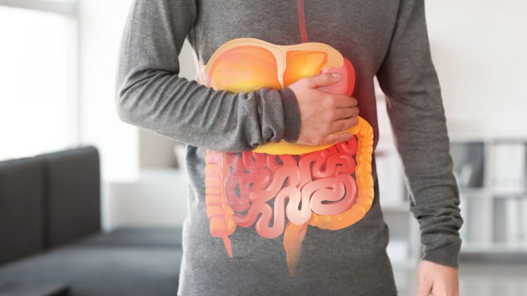 Enfermedad de Crohn: síntomas y causas