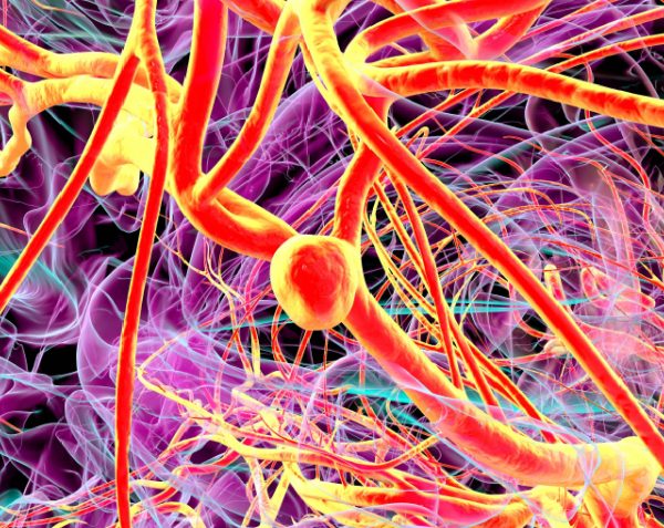 Aneurisma: ¿Qué es y cómo afecta?