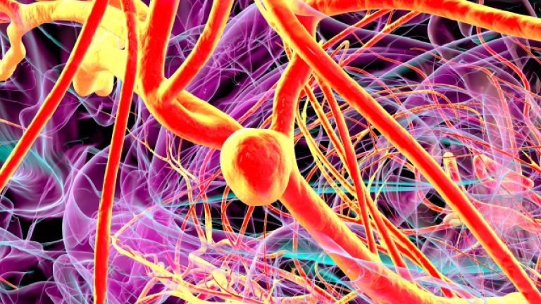 Aneurisma: ¿Qué es y cómo afecta?