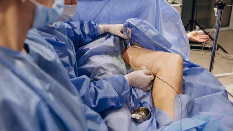 Comprendiendo la trombosis: Factores y síntomas