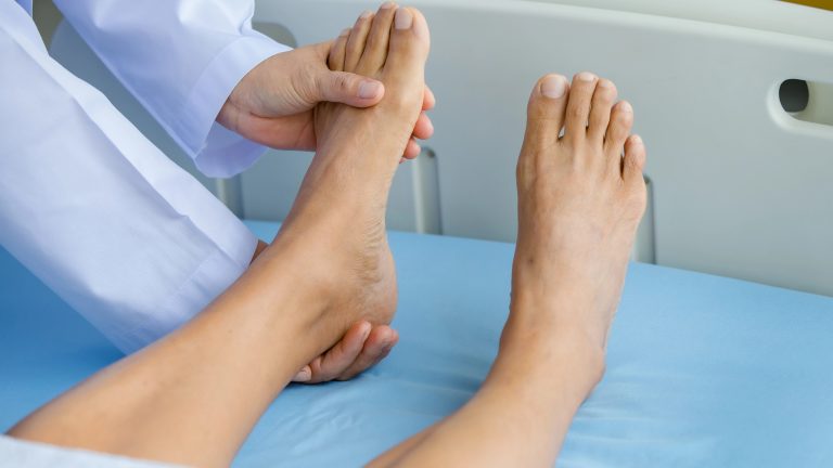 ¿Cuáles son los síntomas del Síndrome de Guillain-Barré?