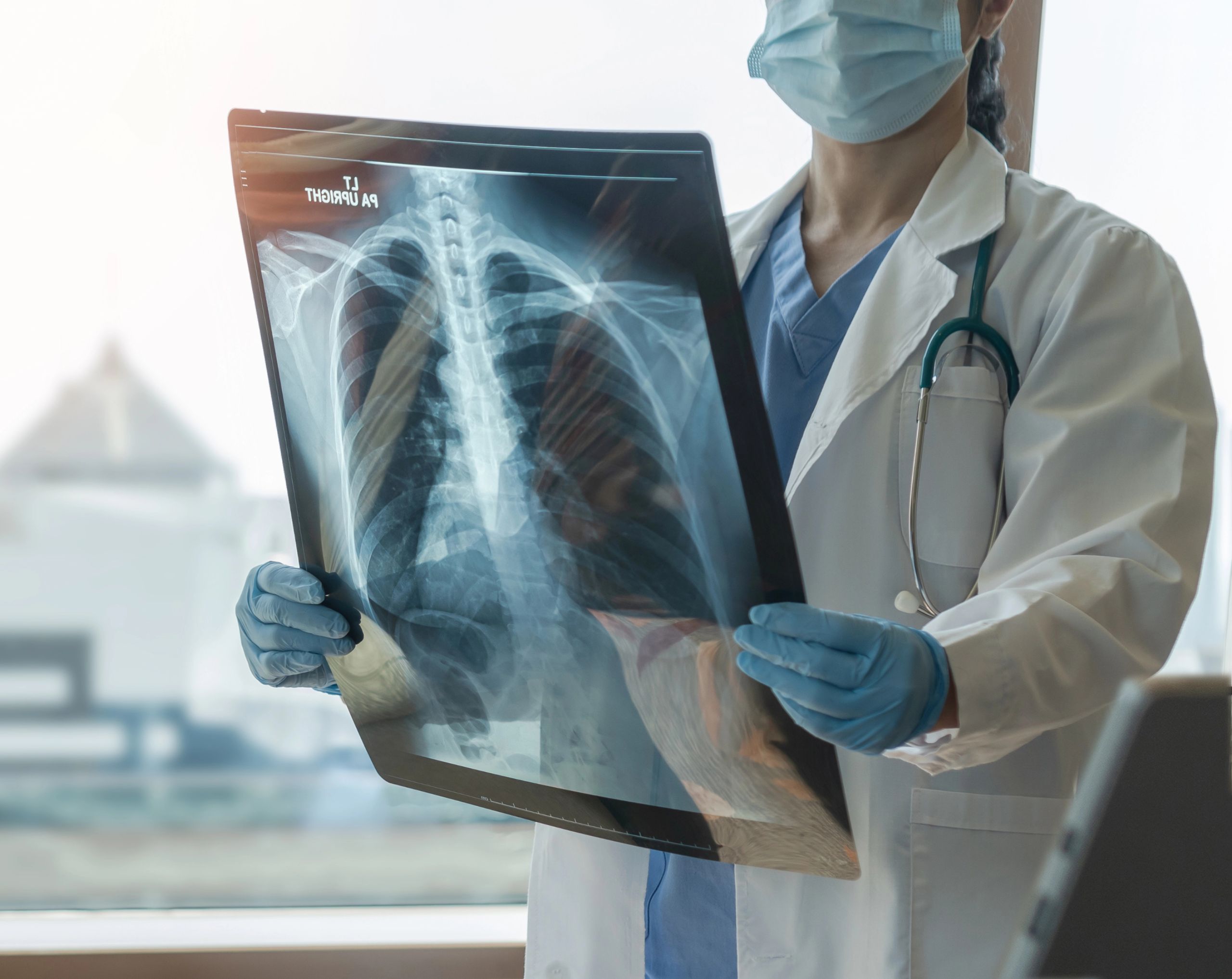 Médico neumólogo revisa una radiografía de pulmón de un paciente con tubercolisis.