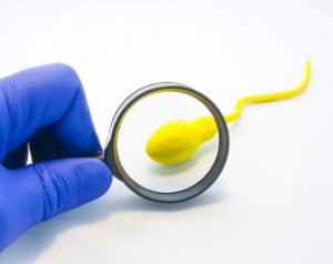 Médico observa un espermatozoide con una lupa para evaluar un posible problema de infertilidad masculina.