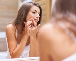 Mujer joven frente al espejo exprime una espinilla en su rostro, síntoma del síndrome premenstrual.