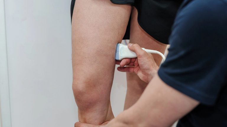 5 síntomas comunes de la trombosis venosa