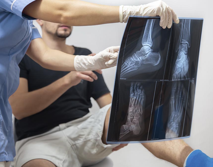 Médico sosteniendo radiografía de paciente con luxación en el pie.