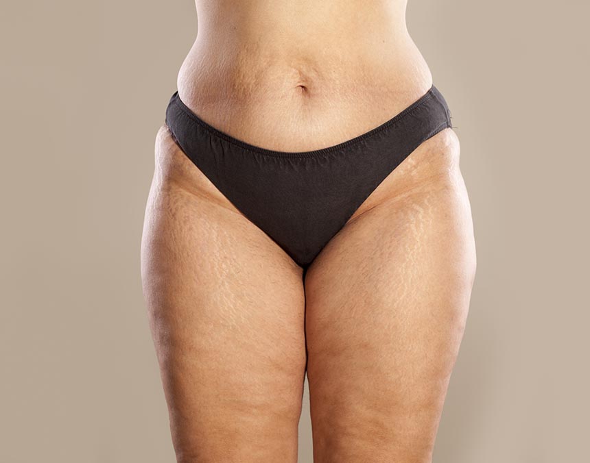 Cuerpo de mujer de la cintura a las rodillas, ropa interior negra.