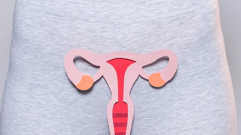 ¿Qué es el cáncer de cuello uterino?