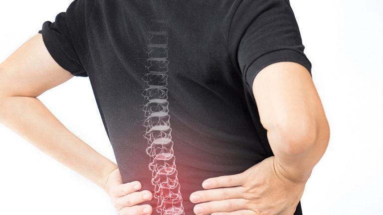 Discartrosis lumbar: ¿Qué es y cómo afecta a tu salud?