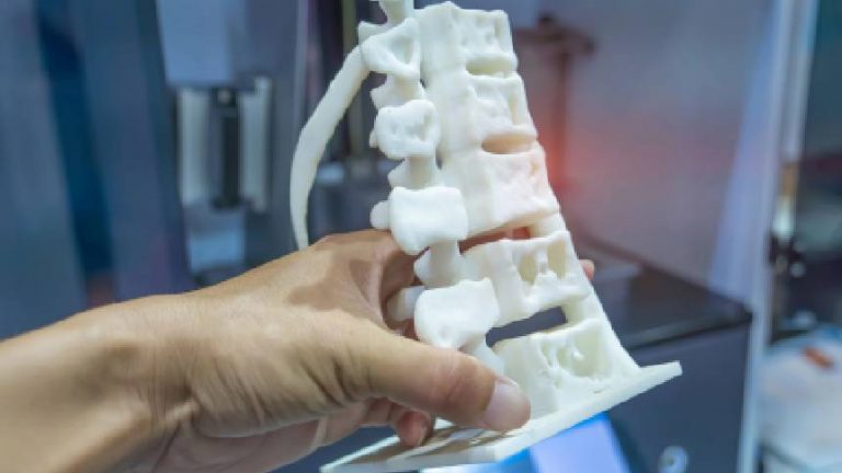 La impresión 3D en medicina | Avances