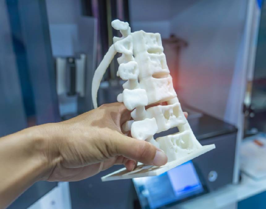 La-impresión-3D-en-medicina-Avances