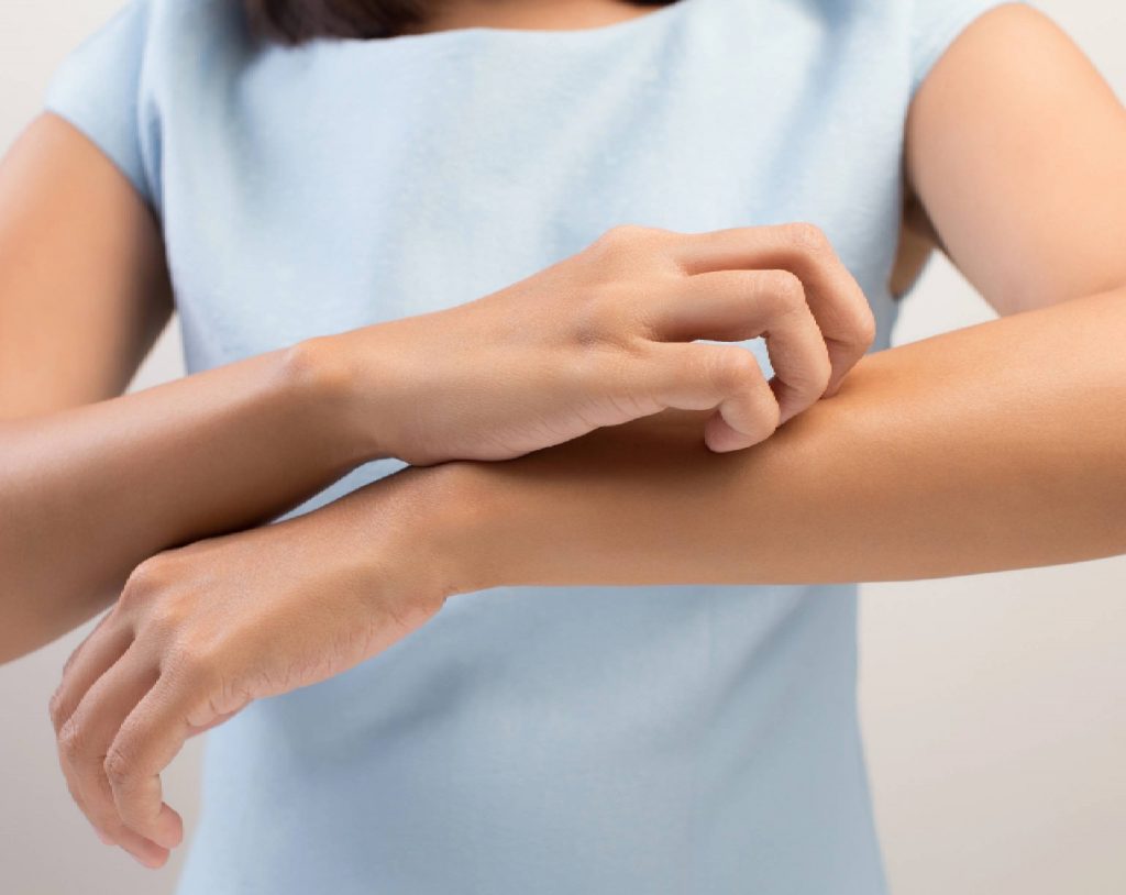 Mujer de edad media vistiendo ropa de color azul cielo, se rasca el brazo por la incomodidad que le produce una alergia cutánea.