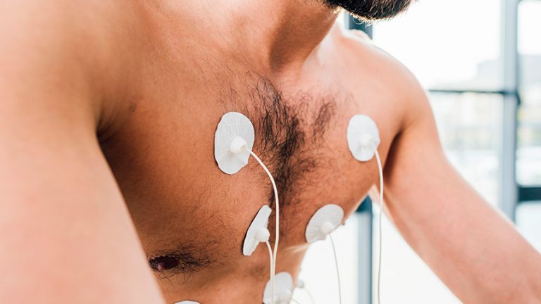 Cardiología preventiva: chequeos y hábitos para un corazón sano