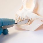 cirugía-maxilofacial-qué-es-y-cuándo-es-necesaria