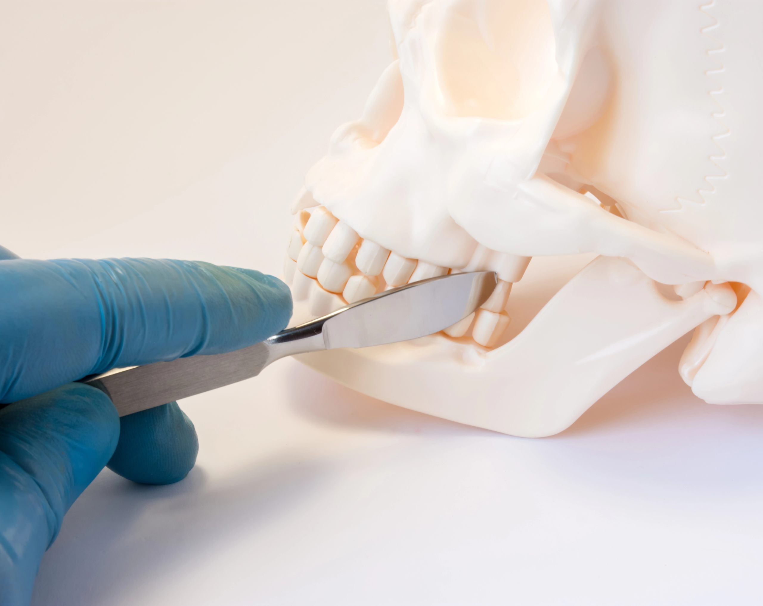 cirugía-maxilofacial-qué-es-y-cuándo-es-necesaria